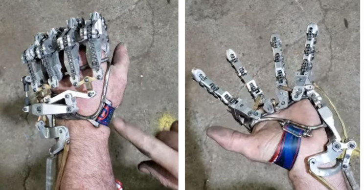 After The Medical Insurance Company Declined To Pay For A Bionic Hand, A Man Created His Own Working One